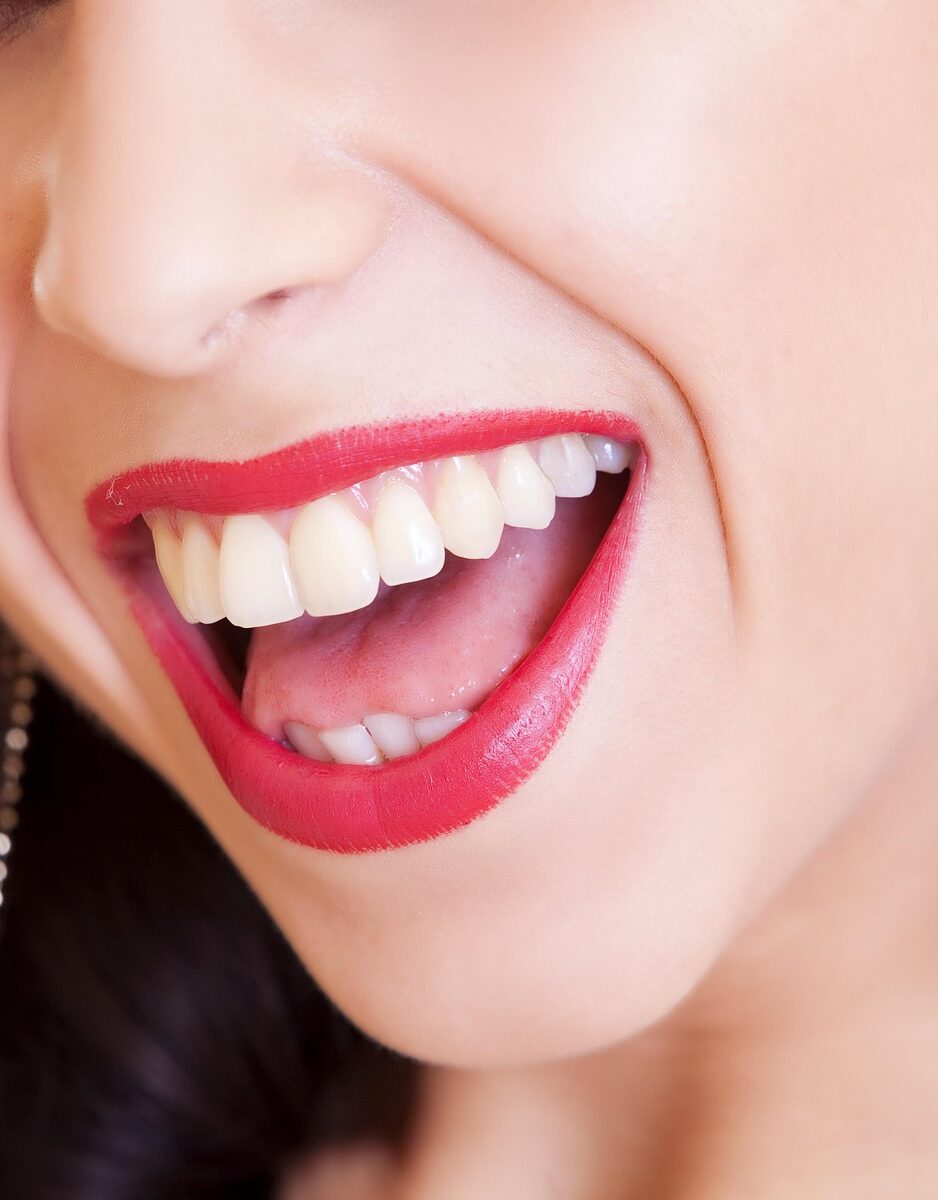 Kosmetisches Zahnbleaching – Für ein Lächeln, das strahlt wie Du